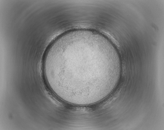 X0000115030439200911161510