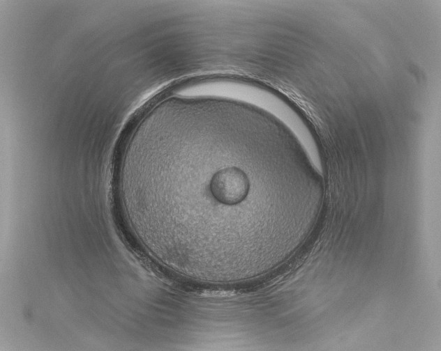 X0000115030440200911161510