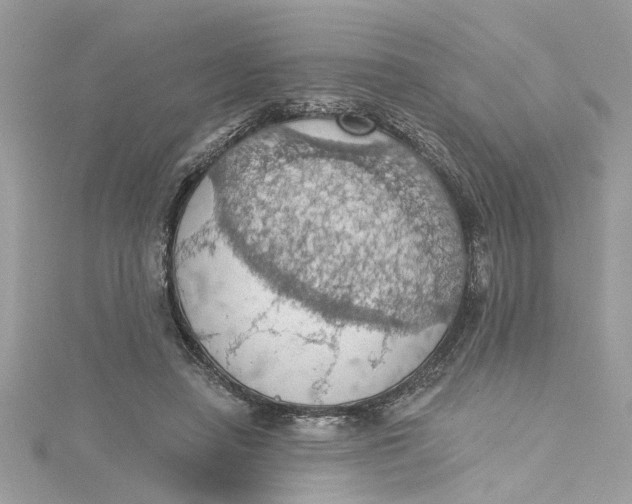 X0000115030450200911161510