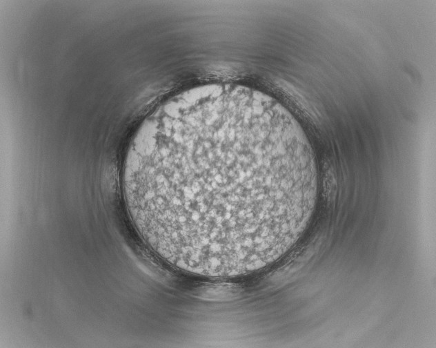 X0000115030459200911161510