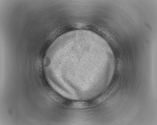 X0000115030461200911161510