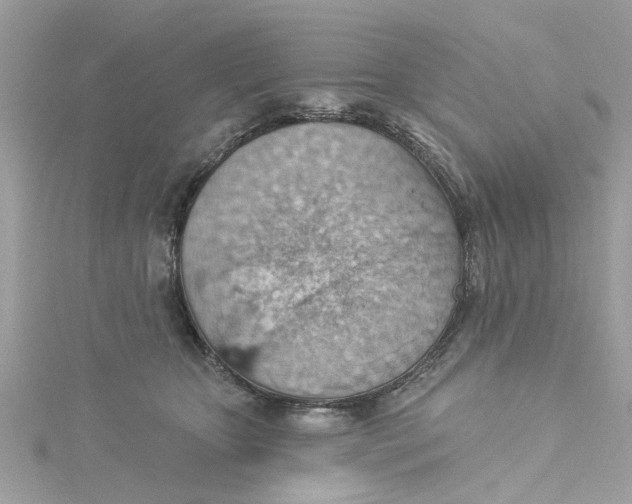 X0000115030467200911161510