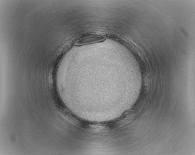 X0000115030516200911161509