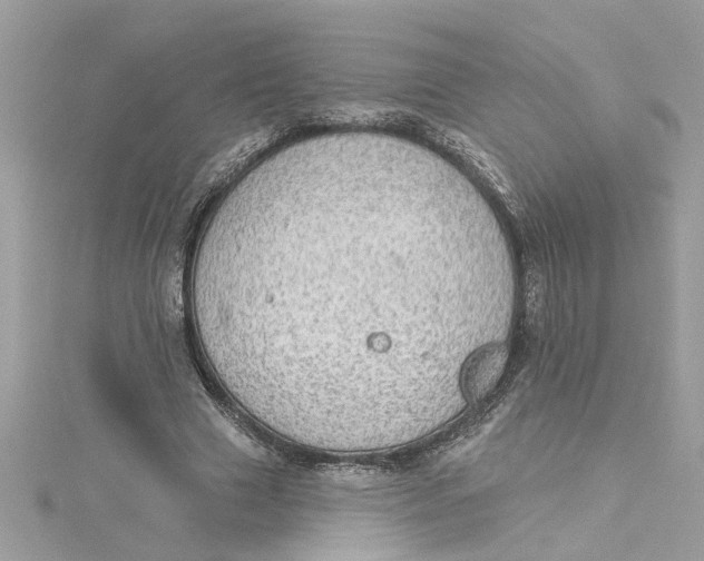 X0000115030633200911161507