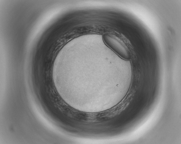 X0000115030766200911161507