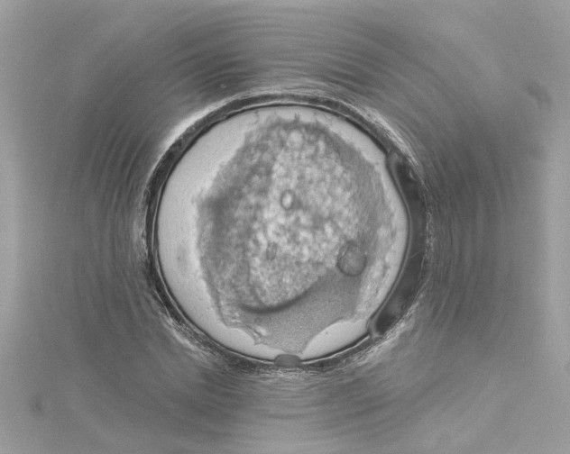 X0000115030830200911161505