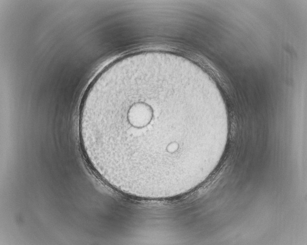 X0000115030836200911161505