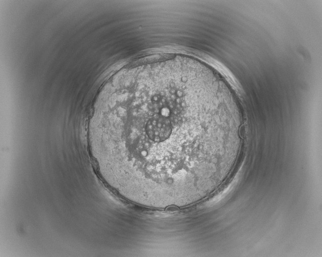 X0000115030857200911161505