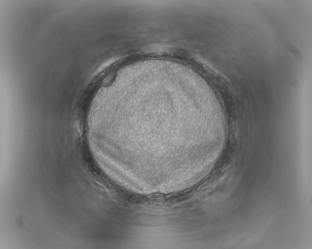 X0000115031206200911161500