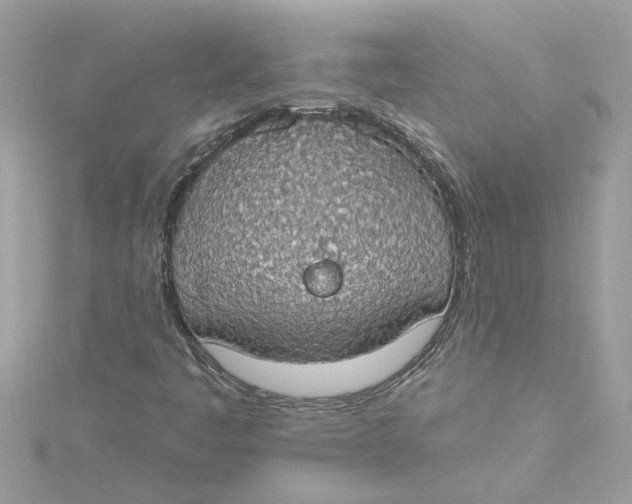 X0000115031445200911161457