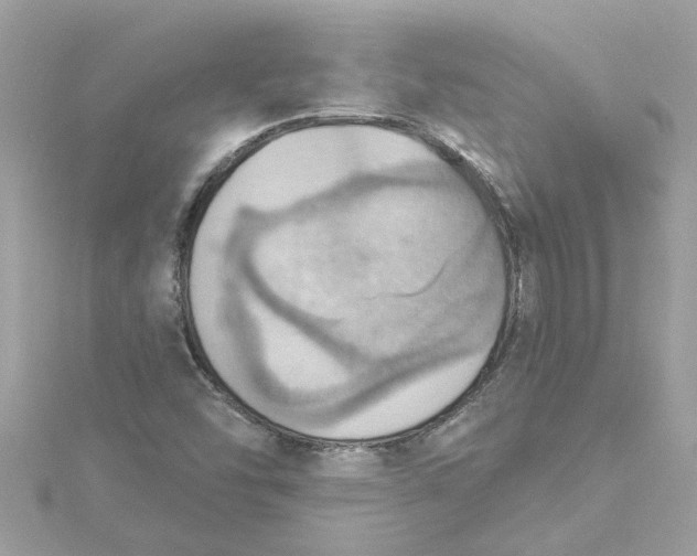 X0000115031454200911161457