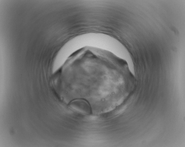 X0000115030139200911231120