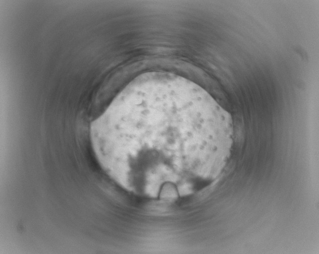 X0000115030179200911231120