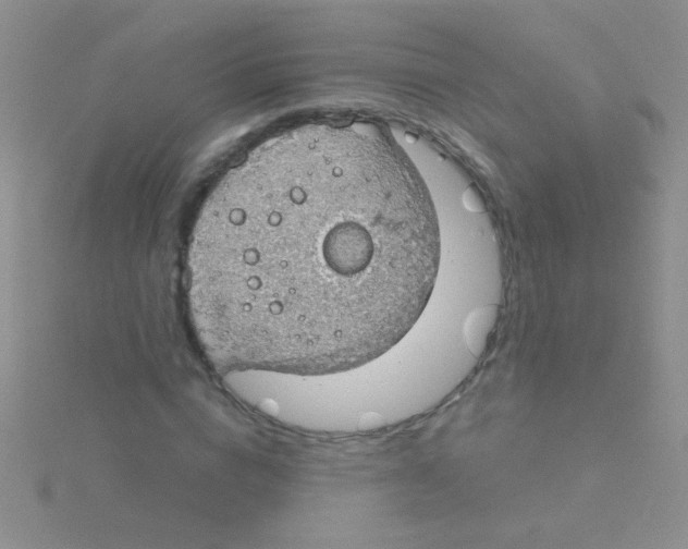 X0000115030824200911231111