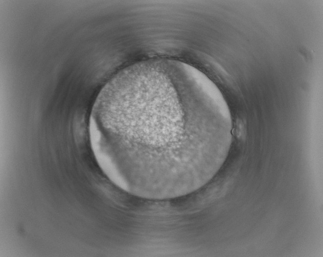 X0000115030915200911231109