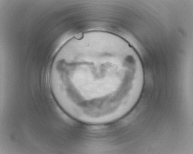 X0000115031290200911231104