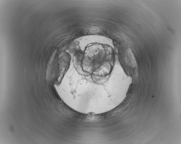 X0000115030177200912071056