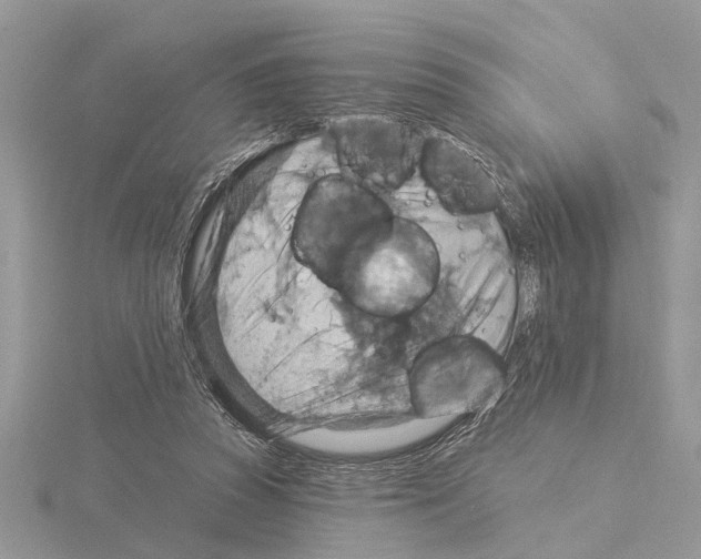 X0000115030353200912071053