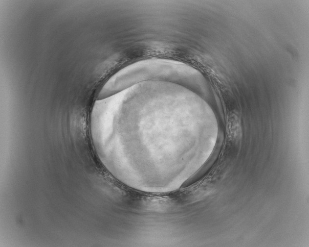 X0000115030716200912071049