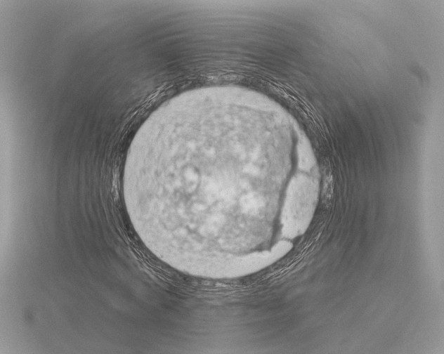 X0000115030772200912071048