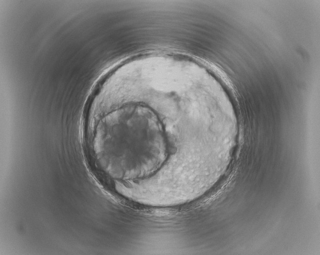 X0000115030839200912071047