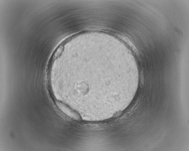 X0000115030976200912071045