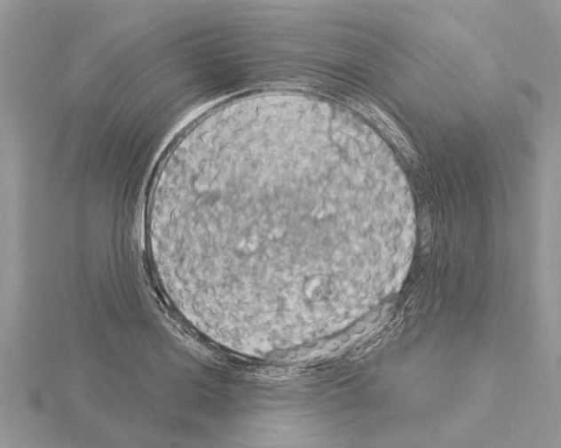 X0000115031036200912071044