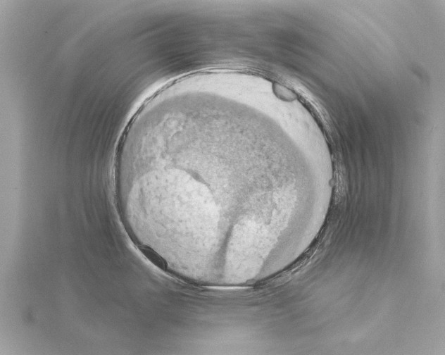 X0000115031487200912071038