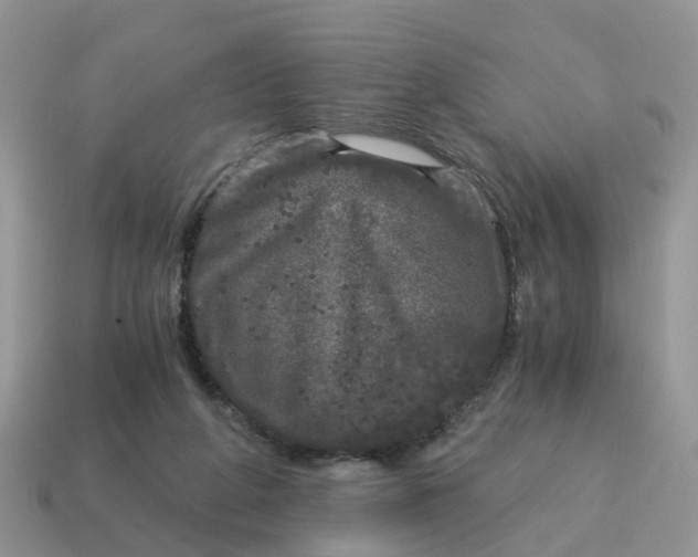 X0000115040210200911091411
