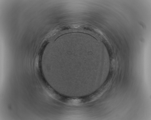 X0000115040217200911091411