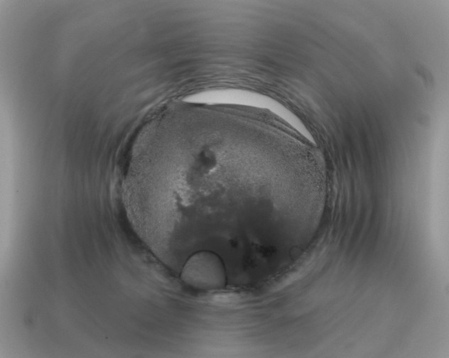 X0000115040228200911091411