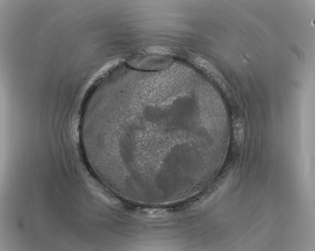 X0000115040395200911091409