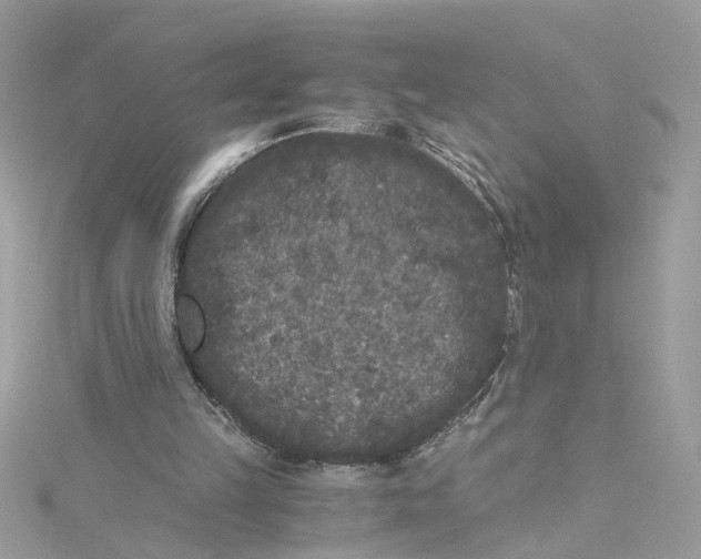 X0000115040149200911161534