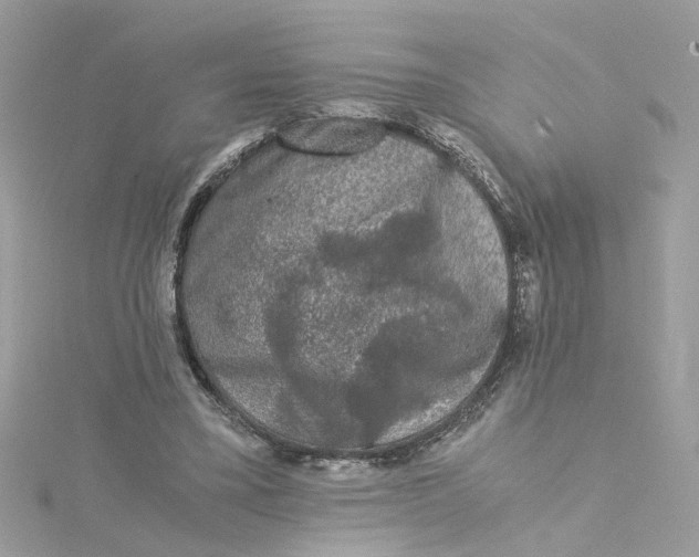 X0000115040395200911161531