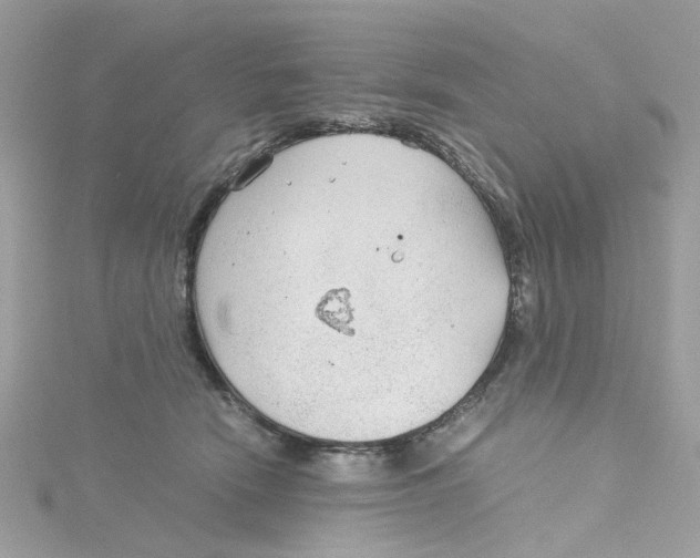 X0000115040466200911161531