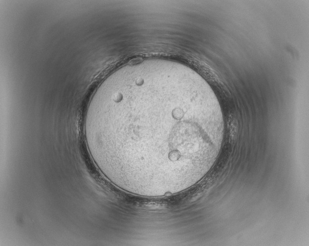 X0000115040546200911161529