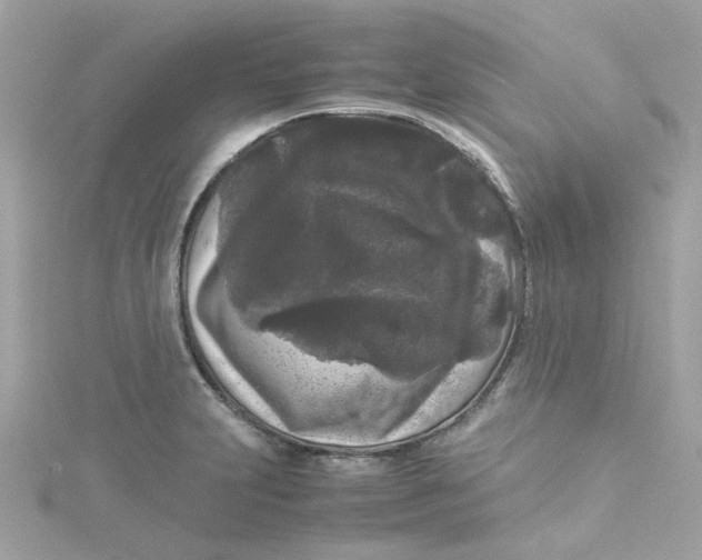 X0000115041231200911161520