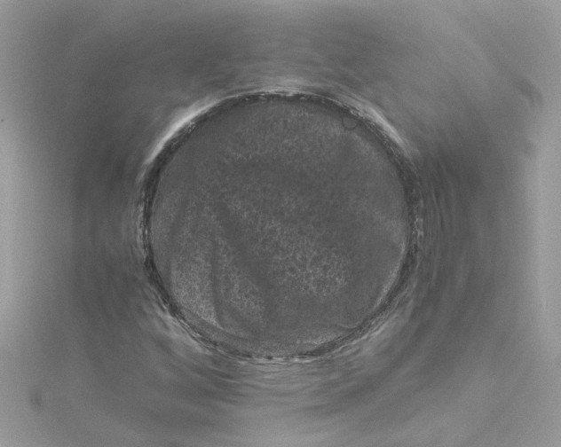 X0000115041256200911161520