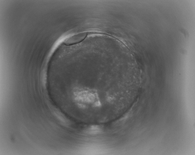 X0000115040056200911231141