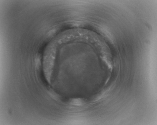 X0000115040127200911231140