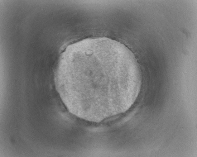 X0000115040144200911231140