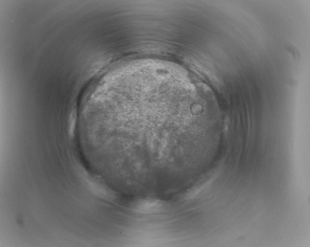 X0000115040206200911231139