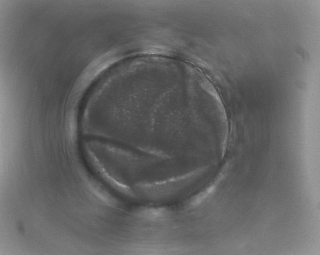 X0000115040247200911231138