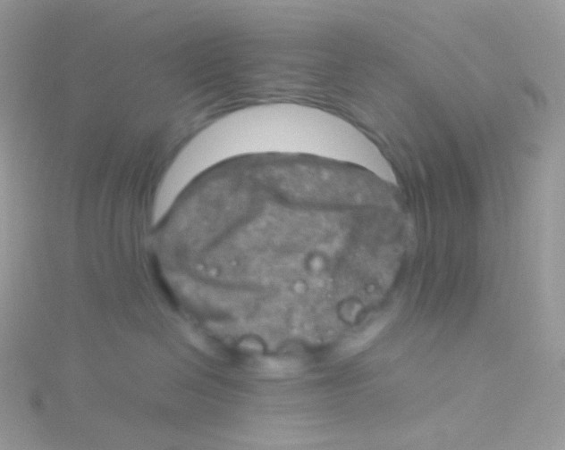 X0000115040286200911231139