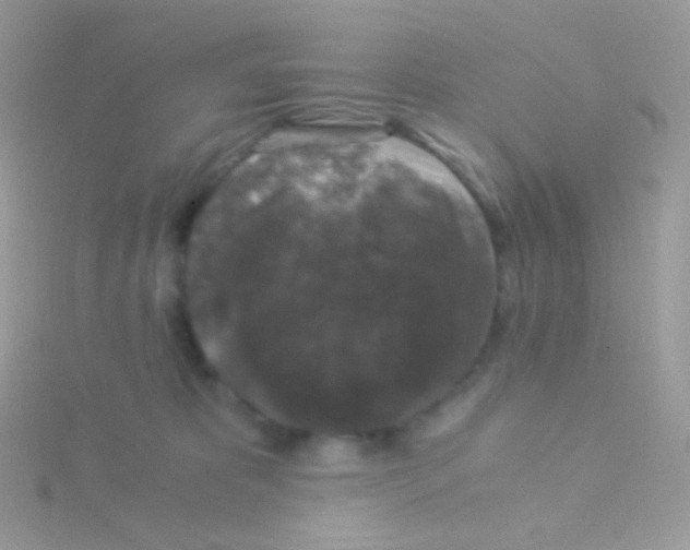 X0000115040325200911231138