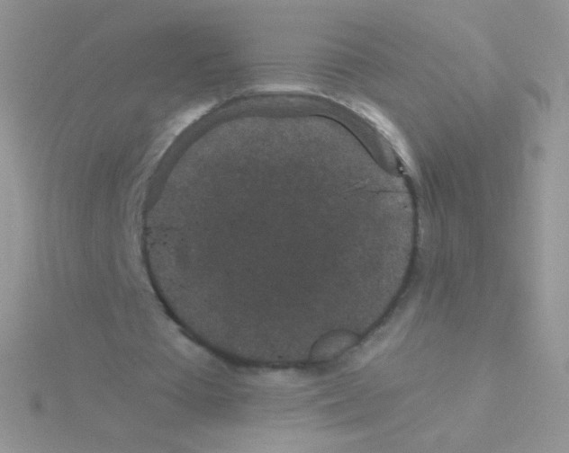 X0000115040385200911231137