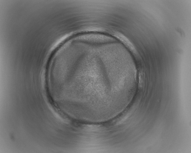 X0000115040436200911231136