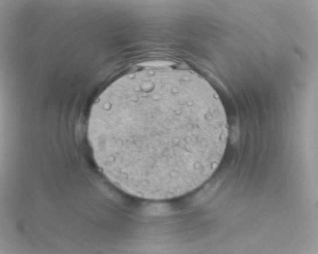 X0000115040476200911231136