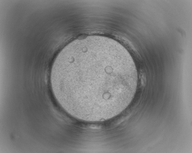 X0000115040546200911231135