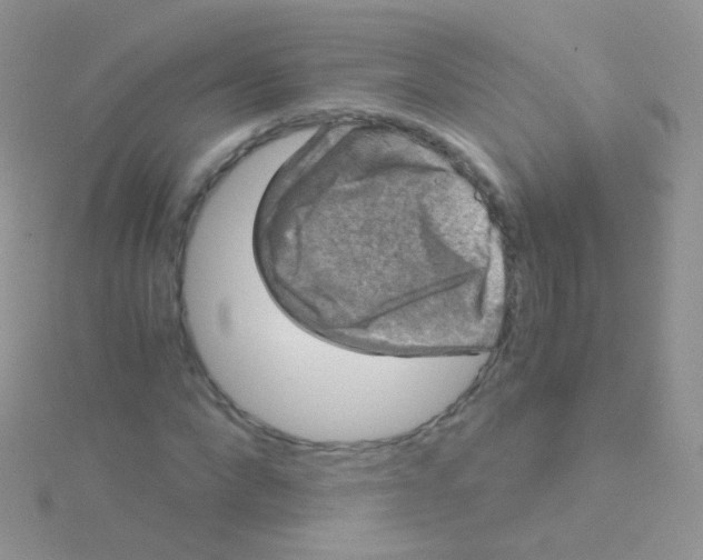 X0000115040872200911231130